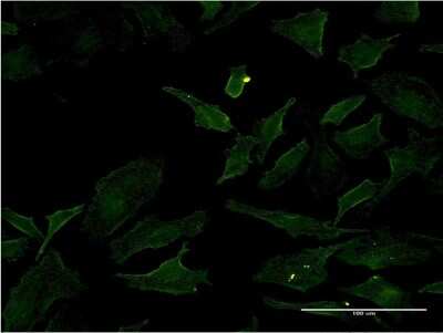 Immunocytochemistry/Immunofluorescence: B-Raf Antibody (2F7) [H00000673-M04] - Analysis of monoclonal antibody to BRAF on HeLa cell. Antibody concentration 10 ug/ml