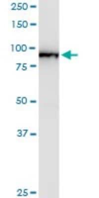 Western Blot: B-Raf Antibody (3D2) [H00000673-M02] - BRAF monoclonal antibody (M02), clone 3D2. Analysis of BRAF expression in human pancreas.