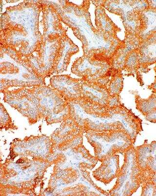 B-Raf Antibody (IHC600) - V600-E Mutation (NBP3-00517): Novus Biologicals