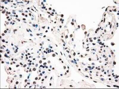 Immunohistochemistry: B-Raf Antibody (OTI5A9) - Azide and BSA Free [NBP2-70260] - Staining of paraffin-embedded Human endometrium tissue using anti-B Raf mouse monoclonal antibody.