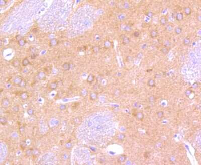 Immunohistochemistry-Paraffin: B-Raf Antibody (SU34-04) [NBP2-67469] - Analysis of paraffin-embedded rat brain tissue using anti-B Raf antibody. Counter stained with hematoxylin.