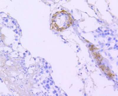 Immunohistochemistry-Paraffin: B-Raf Antibody (SU34-04) [NBP2-67469] - Analysis of paraffin-embedded rat testis tissue using anti-B Raf antibody. Counter stained with hematoxylin.