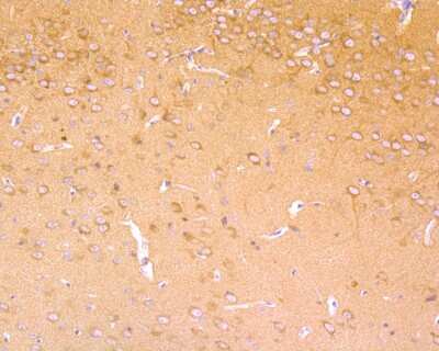 Immunohistochemistry-Paraffin: B-Raf Antibody (SU34-04) [NBP2-67469] - Immunohistochemical analysis of paraffin-embedded mouse brain tissue using anti-B-Raf antibody. The section was pre-treated using heat mediated antigen retrieval with Tris-EDTA buffer (pH 8.0-8.4) for 20 minutes. The tissues were blocked in 5% BSA for 30 minutes at room temperature, washed with ddH2O and PBS, and then probed with the primary antibody (ET1608-36, 1/50) for 30 minutes at room temperature. The detection was performed using an HRP conjugated compact polymer system. DAB was used as the chromogen. Tissues were counterstained with hematoxylin and mounted with DPX.