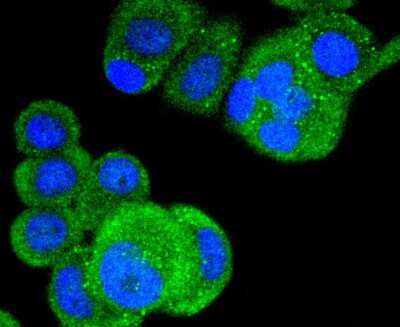 Immunocytochemistry/Immunofluorescence: B-Raf [p Thr401] Antibody (JJ08-72) [NBP2-67846] - Staining Phospho-B Raf(T401) in MCF-7 cells (green). The nuclear counter stain is DAPI (blue). Cells were fixed in paraformaldehyde, permeabilised with 0.25% Triton X100/PBS.