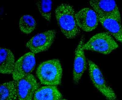 Immunocytochemistry/Immunofluorescence: B-Raf [p Thr401] Antibody (JJ08-72) [NBP2-67846] - Staining Phospho-B Raf(T401) in PC-3M cells (green). The nuclear counter stain is DAPI (blue). Cells were fixed in paraformaldehyde, permeabilised with 0.25% Triton X100/PBS.
