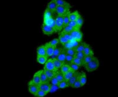 Immunocytochemistry/Immunofluorescence: B-Raf [p Thr401] Antibody (JJ08-72) [NBP2-67846] - Staining Phospho-B Raf(T401) in PC-12 cells (green). The nuclear counter stain is DAPI (blue). Cells were fixed in paraformaldehyde, permeabilised with 0.25% Triton X100/PBS.