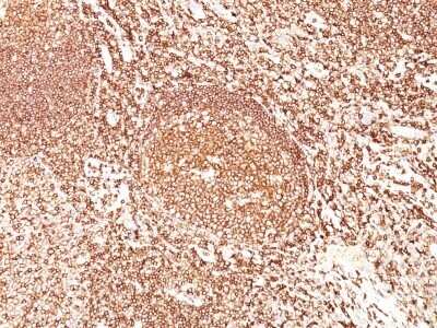 Immunohistochemistry-Paraffin: B220/CD45R Antibody (F10-89-4) - Azide and BSA Free [NBP2-54455] - Human Tonsil stained with CD45 Monoclonal Antibody (F10-89-4).