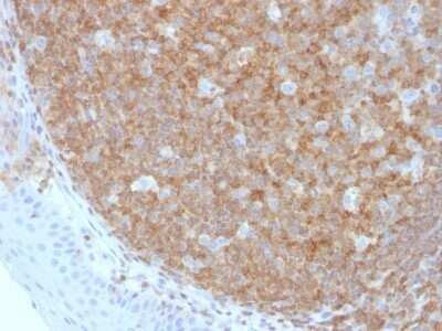 Immunohistochemistry-Paraffin: B220/CD45R Antibody (F10-89-4) - Azide and BSA Free [NBP2-54455] - Formalin-fixed, paraffin-embedded human Tonsil stained with B220/CD45R Antibody (F10-89-4).