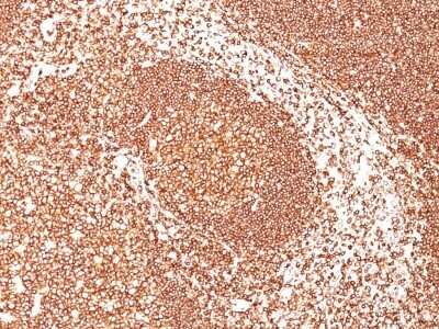 Immunohistochemistry-Paraffin: B220/CD45R Antibody (PTPRC/1461) - Azide and BSA Free [NBP2-54464] - Human Tonsil stained with CD45 Monoclonal Antibody (PTPRC/1461).