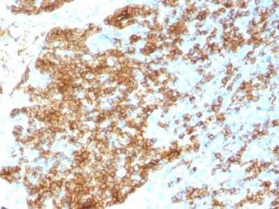 Immunohistochemistry-Paraffin: B220/CD45R Antibody (PTPRC/1783R) - Azide and BSA Free [NBP2-54578] - Human Tonsil stained with CD45RB Recombinant Rabbit Monoclonal Antibody (PTPRC/1783R).