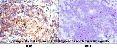 Dual RNAscope ISH-IHC: B220/CD45R Antibody (RA3-6B2) [NB100-77420] - Formalin-fixed paraffin-embedded tissue sections of human tonsil were probed for CD45 mRNA (ACD RNAScope probe, catalog # 418801; Fast Red chromogen, ACD catalog # 322500). Adjacent tissue section was processes for immunohistochemistry using rat monoclonal  (Novus catalog # NB100-77420) at 1:100 dilution for 1 hour at room temperature followed by incubation with the anti-rat IgG VisUCyte HRP Polymer Antibody (Catalog # VC005) and DAB chromogen (yellow-brown). Tissue was counterstained with hematoxylin (blue).