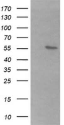 Western Blot: B3GALNT2 Antibody (OTI1G2) - Azide and BSA Free [NBP2-72411] - Analysis of HEK293T cells were transfected with the pCMV6-ENTRY control (Left lane) or pCMV6-ENTRY B3GALNT2.