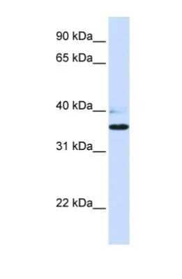 Western Blot B3GALT1 Antibody