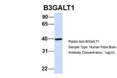 Western Blot B3GALT1 Antibody