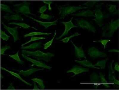 Immunocytochemistry/Immunofluorescence: B3GALT2 Antibody (1D9) [H00008707-M03] - Analysis of monoclonal antibody to B3GALT2 on HeLa cell. Antibody concentration 10 ug/ml