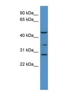 Western Blot B3GALT2 Antibody