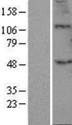 Western Blot B3GALT2 Overexpression Lysate