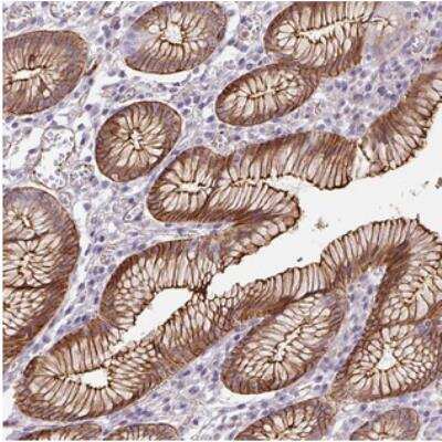 Immunohistochemistry: B3GALT5 Antibody [NBP2-30879] - Staining of human stomach, lower shows strong membranous and cytoplasmic positivity in glandular cells.