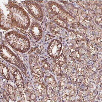 Immunohistochemistry: B3GALT5 Antibody [NBP2-30906] - Staining of human stomach (lower) shows moderate membranous positivity in glandular cells.