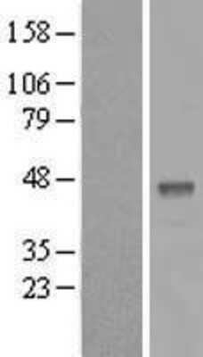 Western Blot: B3GALT5 Overexpression Lysate (Adult Normal) [NBP2-05909] Left-Empty vector transfected control cell lysate (HEK293 cell lysate); Right -Over-expression Lysate for B3GALT5.