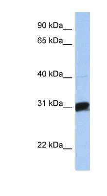 Western Blot: B3GALT6 Antibody [NBP1-62375] - Human Brain lysate, concentration 0.2-1 ug/ml.