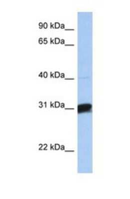 Western Blot: B3GALT6 Antibody [NBP1-69396] - This Anti-B3GALT6 antibody was used in Western Blot of Fetal Brain tissue lysate at a concentration of 1ug/ml.