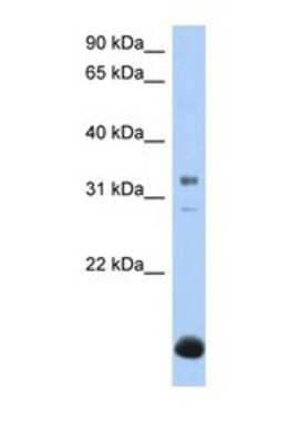 Western Blot B3GALT6 Antibody