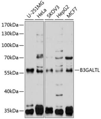 Western Blot: B3GALTL Antibody [NBP2-92573] - Analysis of extracts of various cell lines, using B3GALTL at 1:1000 dilution.Secondary antibody: HRP Goat Anti-Rabbit IgG (H+L) at 1:10000 dilution.Lysates/proteins: 25ug per lane.Blocking buffer: 3% nonfat dry milk in TBST.Detection: ECL Basic Kit .Exposure time: 20s.