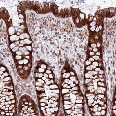 Immunohistochemistry-Paraffin B3GNT9 Antibody - BSA Free