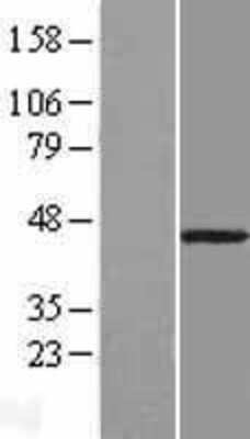 Western Blot: B3GNT9 Overexpression Lysate (Adult Normal) [NBL1-13077] Left-Empty vector transfected control cell lysate (HEK293 cell lysate); Right -Over-expression Lysate for B3GNT9.