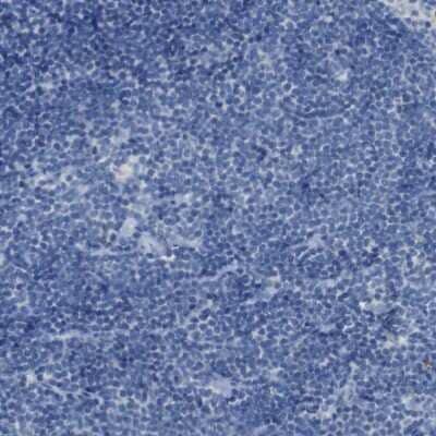 Immunohistochemistry-Paraffin: B4GALNT1 Antibody [NBP1-88663] - Staining of human lymph node shows no positivity in germinal center cells as expected.