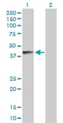Western Blot: B4GALNT1 Antibody [H00002583-D01P] - Analysis of B4GALNT1 expression in transfected 293T cell line by B4GALNT1 polyclonal antibody.Lane 1: B4GALNT1 transfected lysate(35.50 KDa).Lane 2: Non-transfected lysate.
