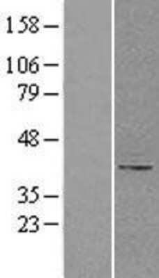 Western Blot: beta-1,4-Galactosyltransferase 1/B4GalT1 Overexpression Lysate [NBL1-07888] - Left-Empty vector transfected control cell lysate (HEK293 cell lysate); Right -Over-expression Lysate for B4GALT1.