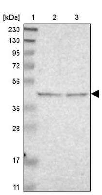 Western Blot B4GALT3 Antibody - BSA Free