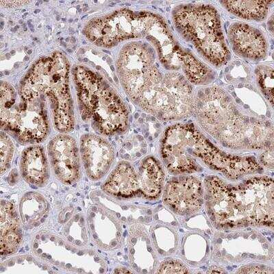 Immunohistochemistry-Paraffin: B4GALT4 Antibody [NBP2-14343] - Staining of human kidney shows strong cytoplasmic and nuclear positivity in cells in tubules.