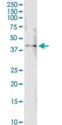 Western Blot: B4GALT4 Antibody [H00008702-D01P] - Analysis of B4GALT4 expression in human spleen.