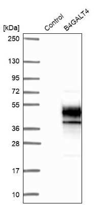 Western Blot: B4GALT4 Antibody [NBP2-14343] - Analysis in control (vector only transfected HEK293T lysate) and B4GALT4 over-expression lysate (Co-expressed with a C-terminal myc-DDK tag (3.1 kDa) in mammalian HEK293T cells).