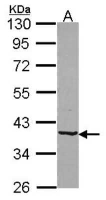 Western Blot: B4GALT4 Antibody [NBP2-15534] - Sample (30 ug of whole cell lysate) A: JurKat 10% SDS PAGE gel, diluted at 1:1000.