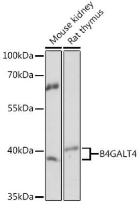 Western Blot: B4GALT4 Antibody [NBP3-15515] - Western blot analysis of extracts of various cell lines, using B4GALT4 Rabbit pAb (NBP3-15515) at 1:1000 dilution. Secondary antibody: HRP Goat Anti-Rabbit IgG (H+L) at 1:10000 dilution. Lysates/proteins: 25ug per lane. Blocking buffer: 3% nonfat dry milk in TBST. Detection: ECL Basic Kit. Exposure time: 1s.