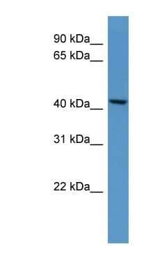 Western Blot: B4GALT5 Antibody [NBP1-69018] - Titration: 0.2-1 ug/ml, Positive Control: Mouse Kidney.