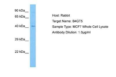 Western Blot: B4GALT5 Antibody [NBP2-86466] - Host: Rabbit. Target Name: B4GALT5. Sample Tissue: Human MCF7 Whole Cell. Antibody Dilution: 1.0ug/ml