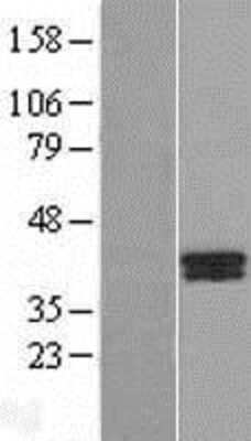 Western Blot: B4GALT7 Overexpression Lysate (Adult Normal) [NBL1-07891] Left-Empty vector transfected control cell lysate (HEK293 cell lysate); Right -Over-expression Lysate for B4GALT7.