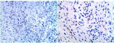 Immunohistochemistry-Paraffin: B7-1/CD80 Antibody (AP-MAB0713) [NBP2-12178] - Formalin fixed and paraffin embedded mouse tumor section was subjected to IHC staining of CD80 using NBP2-12178 (Left panel: x 20; Right panel: x 40).