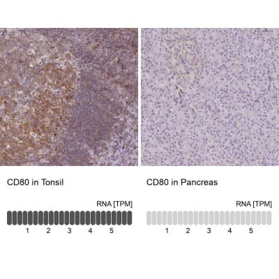 Immunohistochemistry-Paraffin: B7-1/CD80 Antibody [NBP2-48954] - Staining in human tonsil and pancreas tissues using anti-CD80 antibody. Corresponding CD80 RNA-seq data are presented for the same tissues.