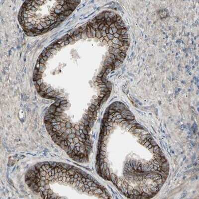 Immunohistochemistry-Paraffin: B7-H3/CD276 Antibody [NBP1-88965] - Staining of human prostate shows high expression.