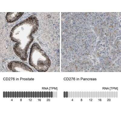 <b>Genetic Strategies Validation and Orthogonal Strategies Validation.</b>Immunohistochemistry-Paraffin: B7-H3/CD276 Antibody [NBP1-88965] - Staining in human prostate and pancreas tissues using anti-CD276 antibody. Corresponding CD276 RNA-seq data are presented for the same tissues.