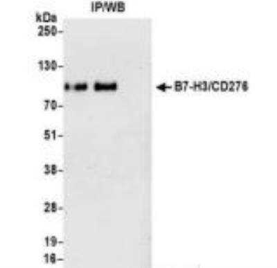 Immunoprecipitation: B7-H3/CD276 Antibody [NBP3-14669] - Samples: Whole cell lysate (1.0 mgper IP reaction; 20% of IP loaded) from HeLa cells preparedusing NETN lysis buffer. Antibodies: Rabbit anti-B7-H3/CD276 recombinant monoclonal antibodyused for IP at 3 ul per reaction. B7-H3/CD276 was also immunoprecipitated by rabbit anti-B7-H3/CD276 recombinant monoclonal antibody. For blotting immunoprecipitated B7-H3/CD27 was used at 1:1000.Chemiluminescence with an exposure time of 30 seconds.