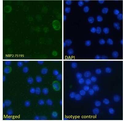 Flow Cytometry: B7-H3/CD276 Antibody (MJ18) - Chimeric [NBP2-75195] - Immunofluorescence staining of fixed mouse splenocytes with anti-B7-H3 (CD276) antibody MJ18. Immunofluorescence analysis of paraformaldehyde fixed mouse (Mus musculus) splenocytes on coverslips, permeabilized with 0.15% Triton stained with the chimeric rabbit version of MJ18 (NBP2-75195) at 10 ug/ml for 1h followed by Alexa Fluor 488 secondary antibody (1 ug/ml), showing weak membrane staining of a subset of cells. The nuclear stain is DAPI (blue). Panels show from left-right, top-bottom NBP2-75195, DAPI, merged channels and an isotype control. The isotype control was stained with an anti-Fluorescein antibody followed by Alexa Fluor 488 secondary antibody