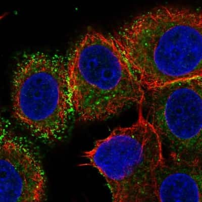 Immunocytochemistry/Immunofluorescence: B7-H4 Antibody [NBP2-30536] - Immunofluorescent staining of human cell line MCF7 shows localization to plasma membrane & cell junctions.