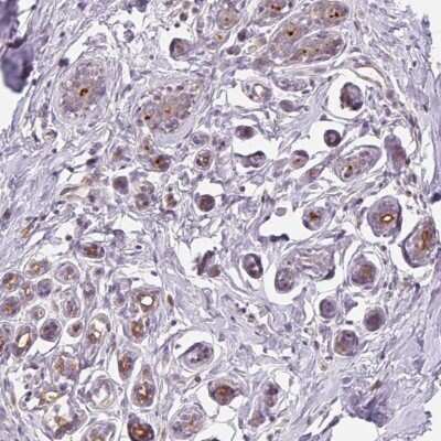 Immunohistochemistry-Paraffin: B7-H4 Antibody [NBP2-30536] - Staining of human breast shows moderate membranous positivity in glandular cells.